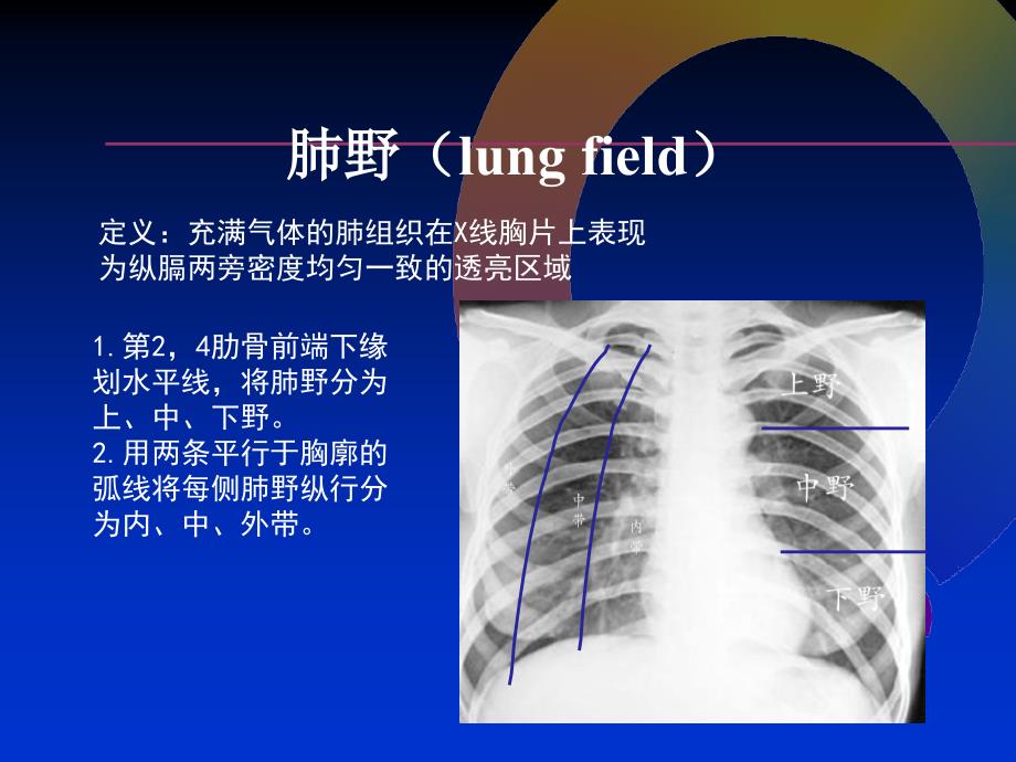 CT MRI颅脑影像看片PPT演示课件_第3页