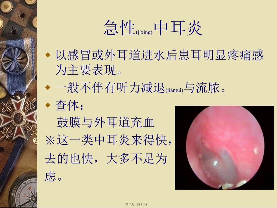 医学专题—儿童中耳炎资料7783_第3页