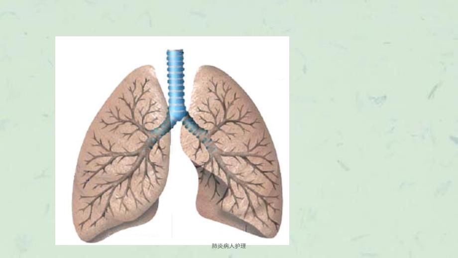 肺炎病人护理课件_第4页