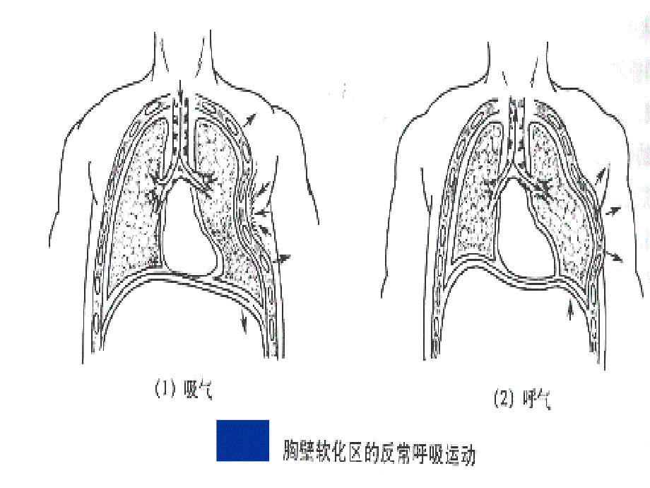 执业护考复习课件_第4页