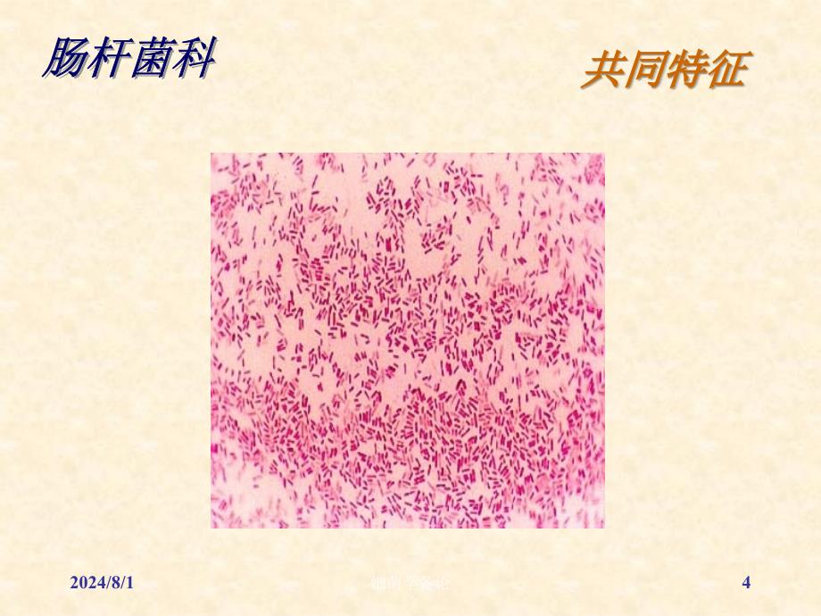 医学微生物学：8 肠杆菌科_第4页