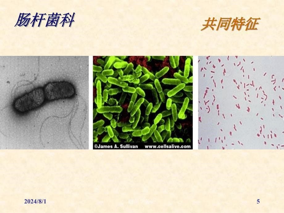 医学微生物学：8 肠杆菌科_第5页