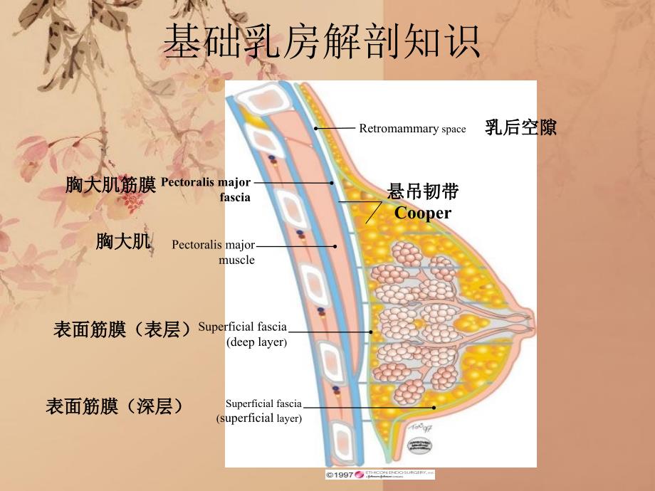 乳腺导管内癌11_第4页