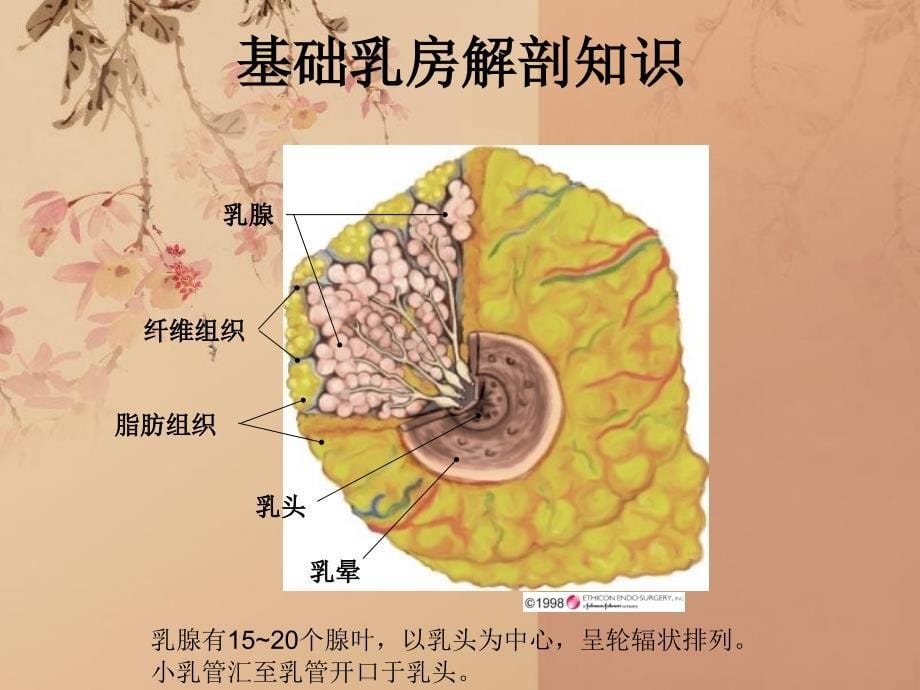 乳腺导管内癌11_第5页