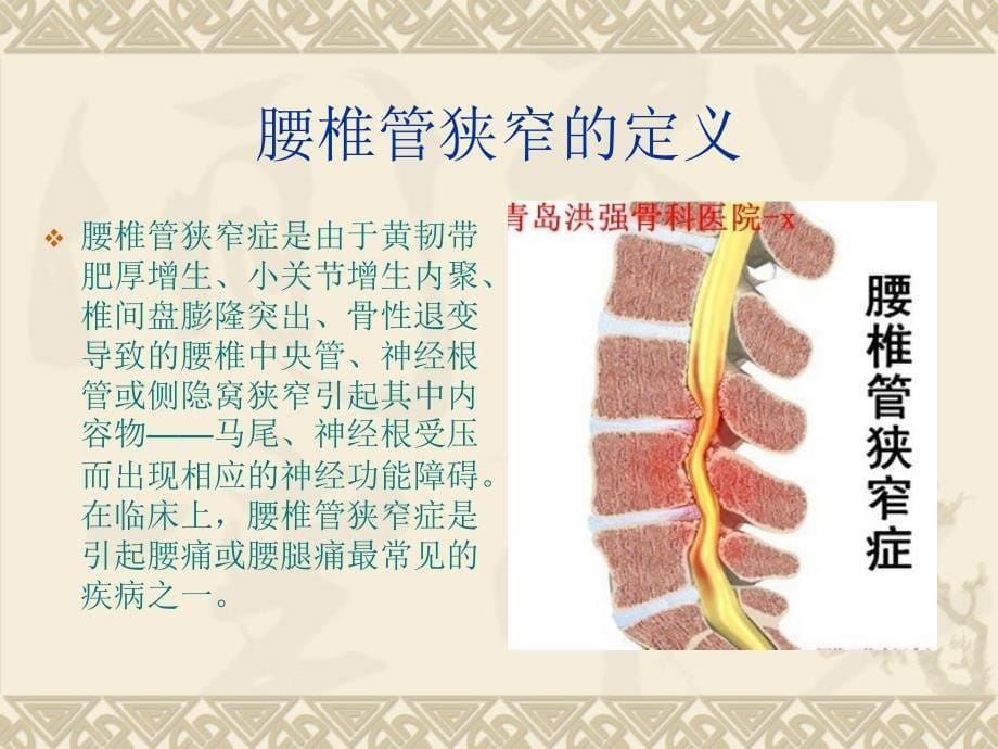 腰椎管狭窄护理查房课件_第5页