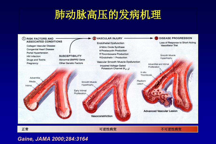 最新：肺动脉高压分类和诊断文档资料_第4页