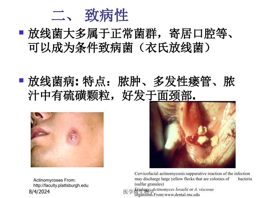 医学微生物学课件-第19章放线菌属与诺卡菌属.ppt_第2页