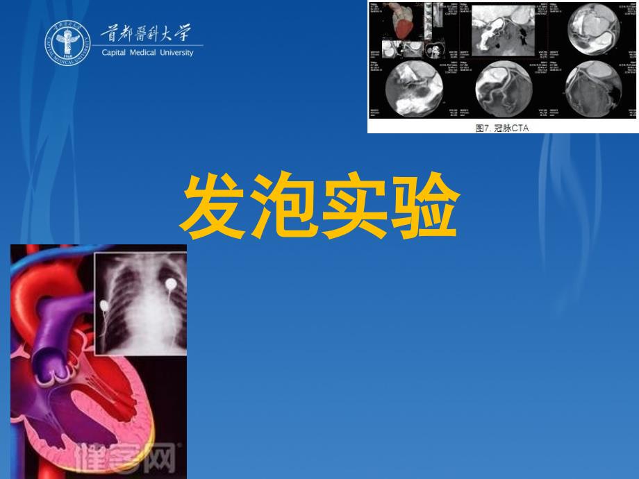 发泡实验.ppt_第1页