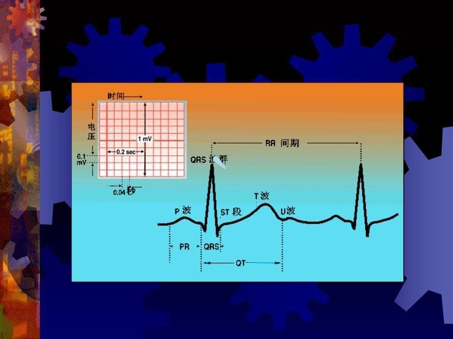 心律失常与心电监护课件_第5页