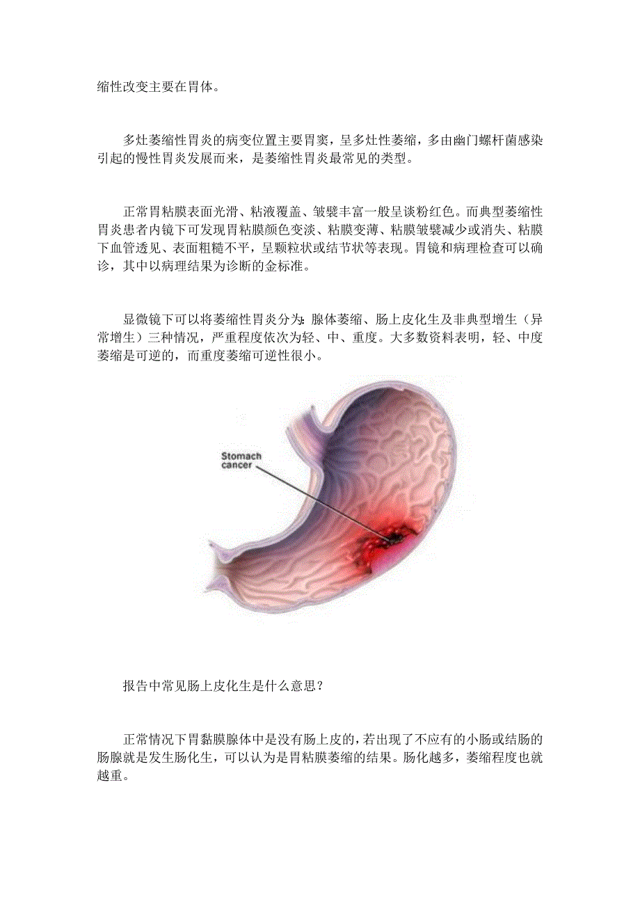 萎缩性胃炎的症状与分类_第2页