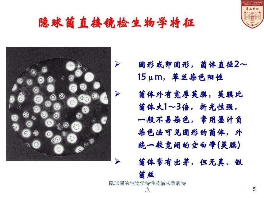 隐球菌的生物学特性及临床致病特点课件_第5页