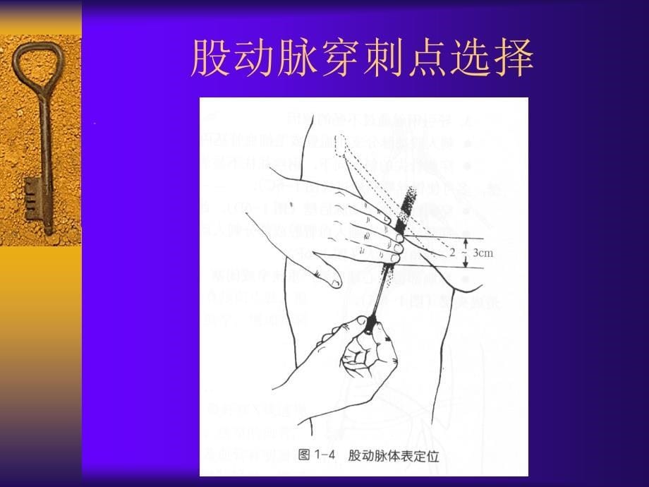 医学专题：冠脉造影穿刺(选)_第5页