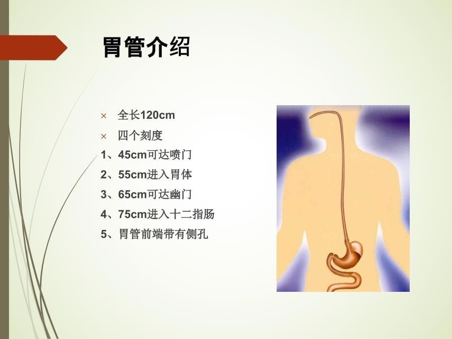 《鼻饲病人的护理》PPT课件_第5页