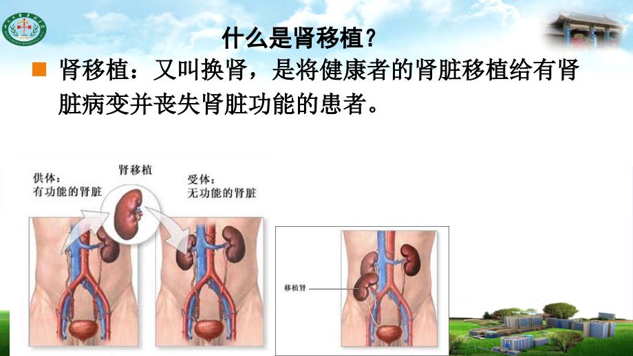 肾移植术后并发症2ppt课件 17页_第2页