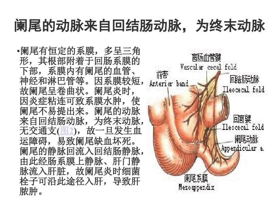 阑尾切除术图解_第5页