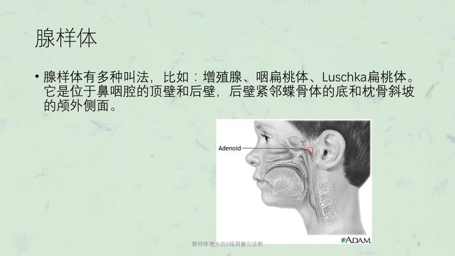 腺样体增大的X线测量与诊断课件_第5页