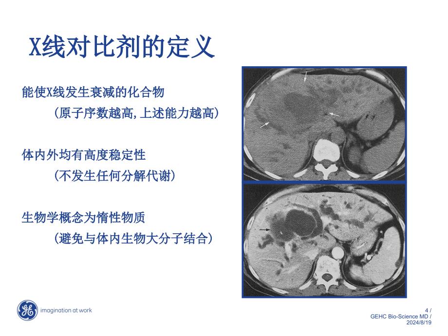 X线对比剂的安全性发展GE_第4页