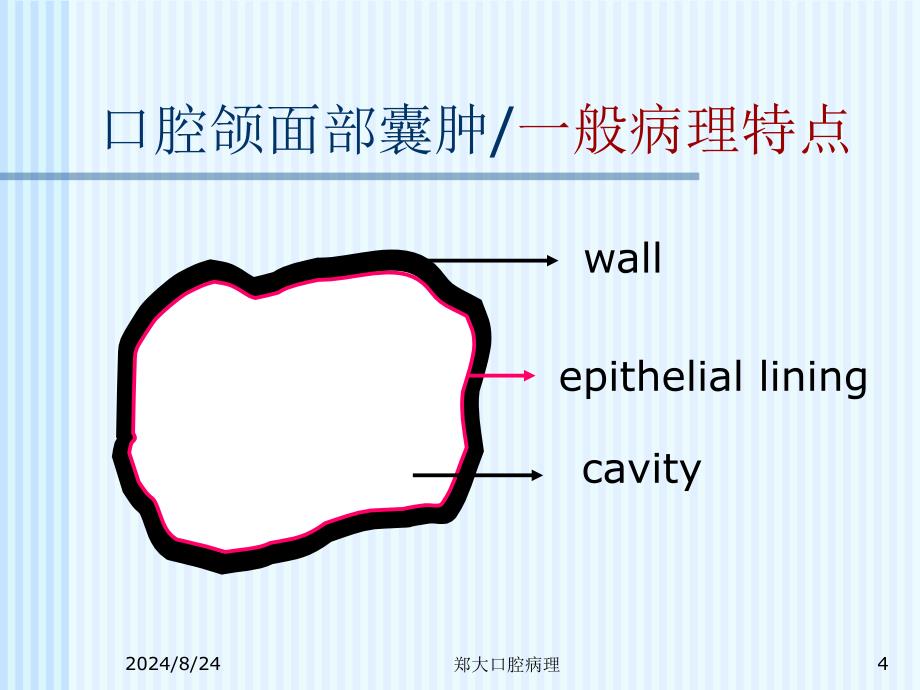 口腔颌面部囊肿_第4页