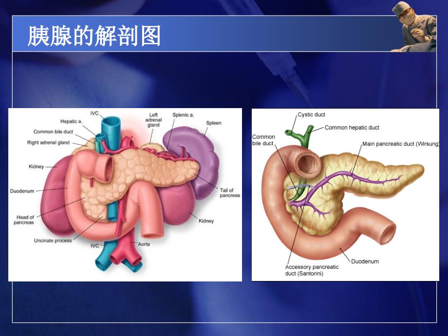 急性胰腺炎小讲课_第4页