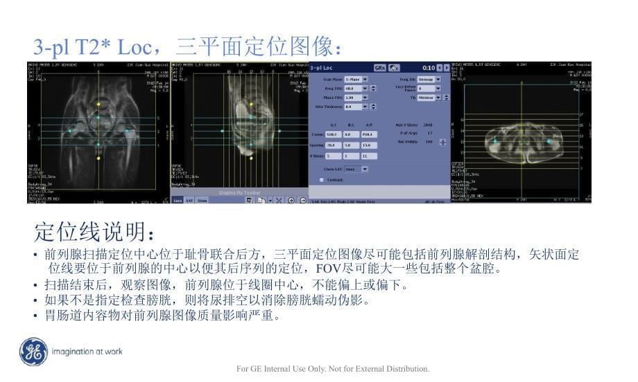 MR男性前列腺规范化扫描方案主题讲座ppt课件_第5页