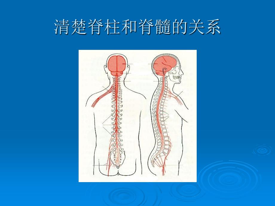 腰硬联合麻醉专家共识_第4页