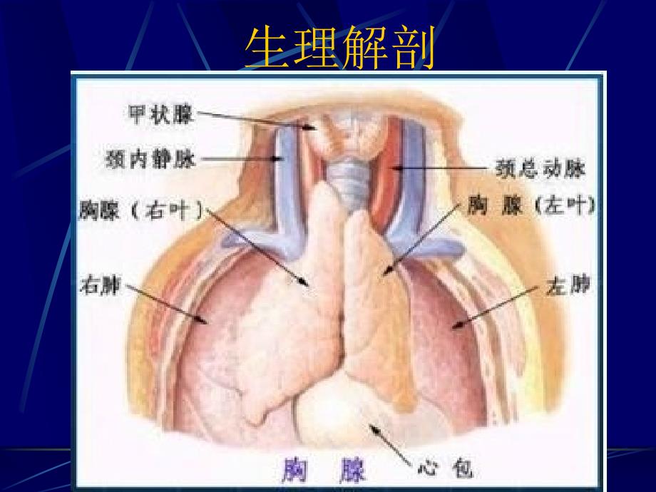 三病区纵膈肿瘤查房_第3页