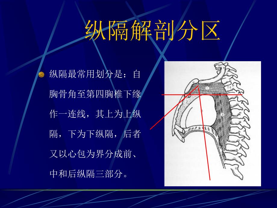 三病区纵膈肿瘤查房_第4页