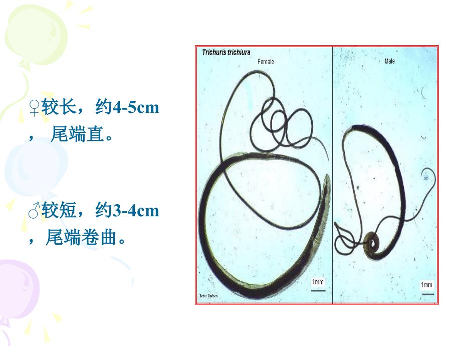 毛首鞭形线虫mondia课件_第3页