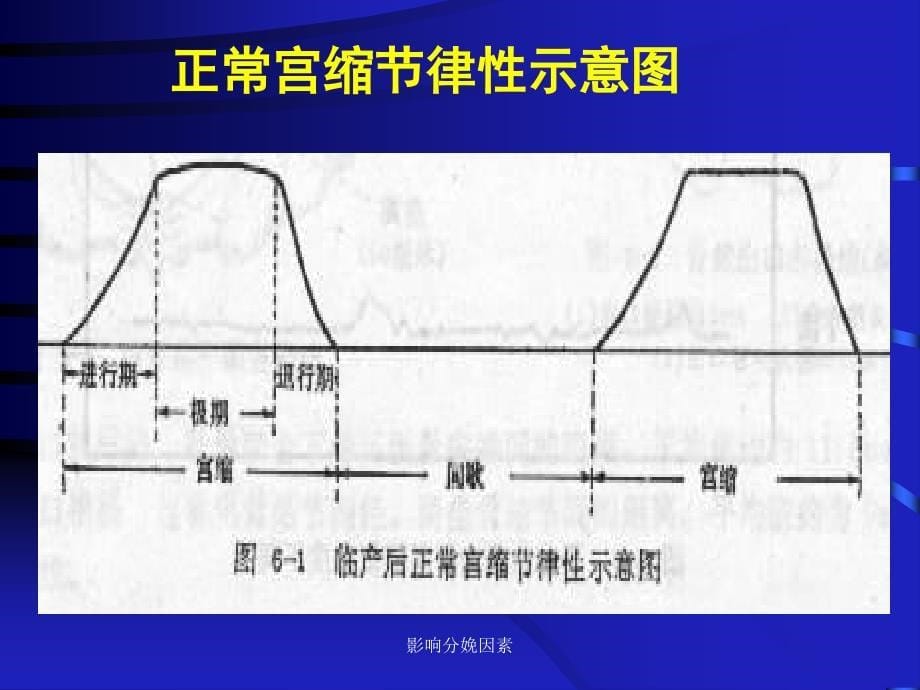 影响分娩因素课件_第5页