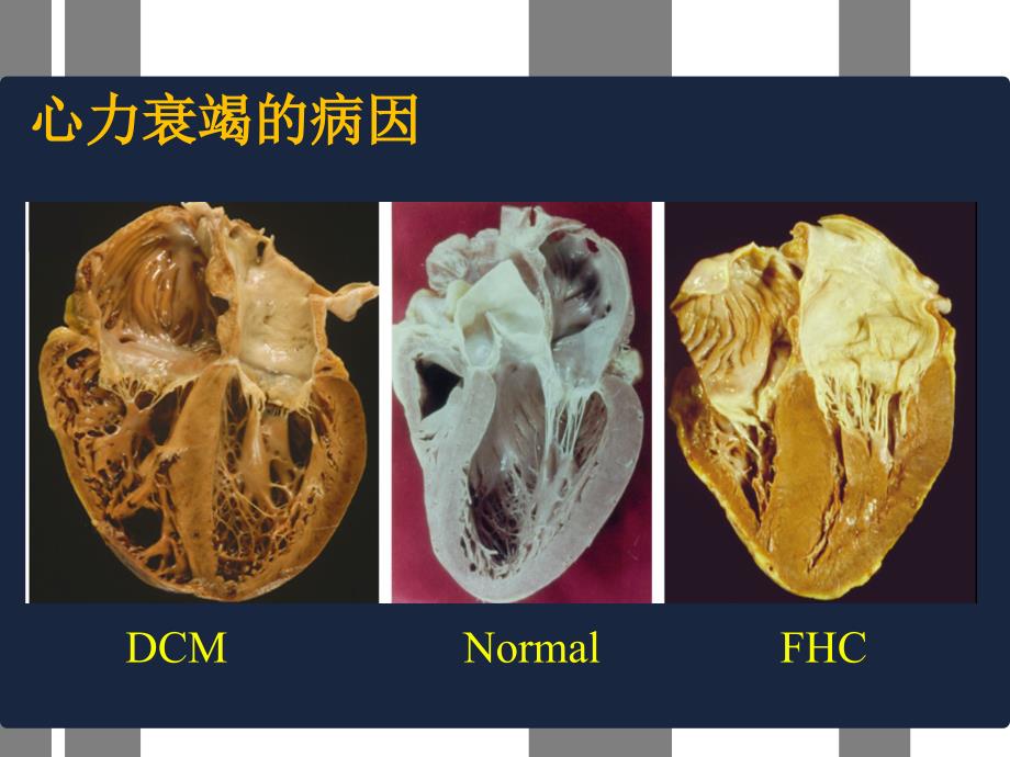 心力衰竭护理新进展ppt幻灯片_第4页