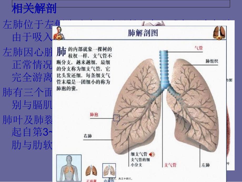 电视胸腔镜下肺大疱2课件_第4页