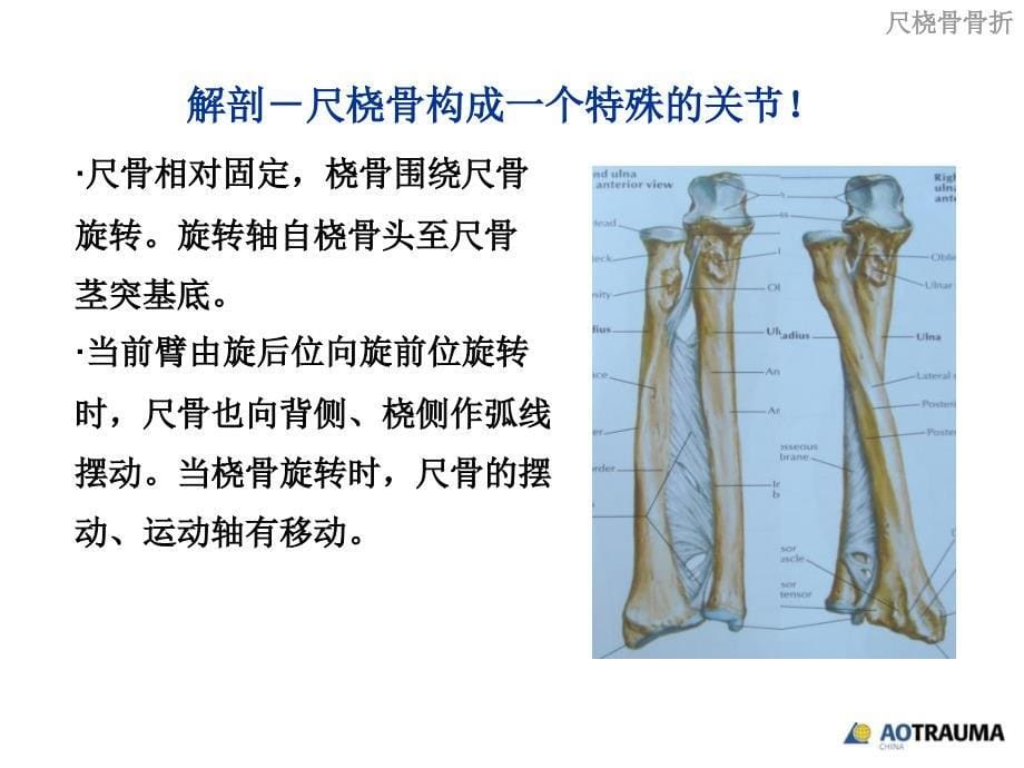 尺桡骨骨折手术原则_第5页