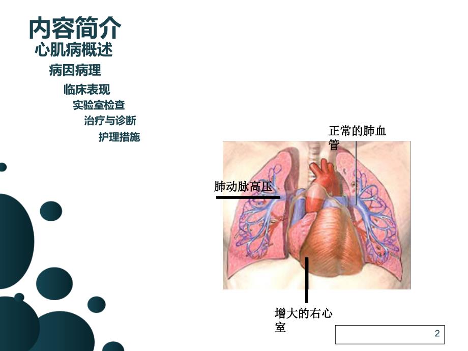 扩张性心肌病的护理查房张性1_第2页