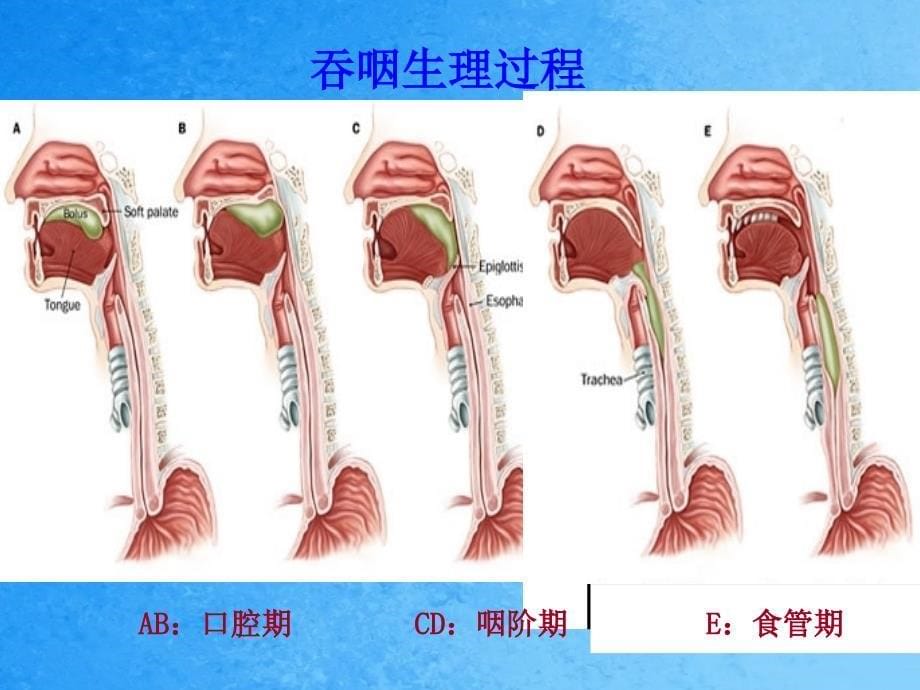 吞咽障碍饮食管理ppt课件_第5页