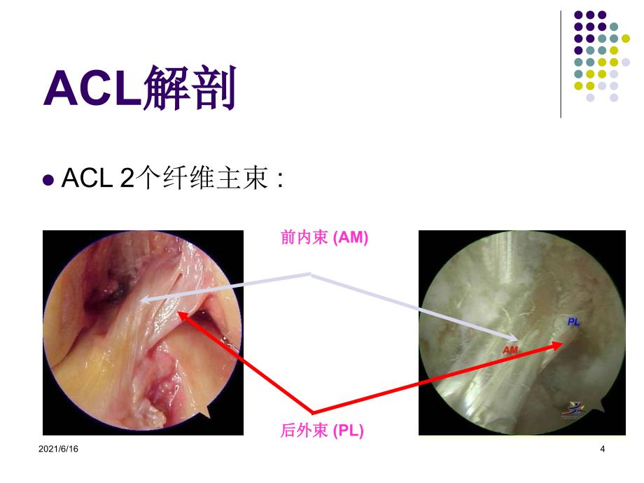 膝关节前交叉韧带损伤诊断与治疗_第4页