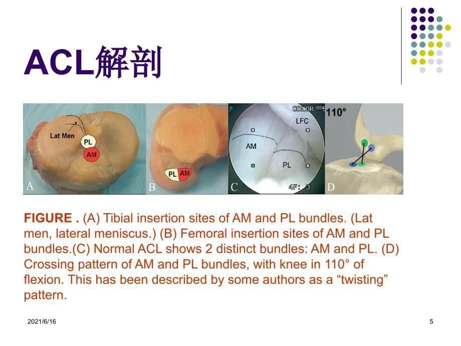 膝关节前交叉韧带损伤诊断与治疗_第5页