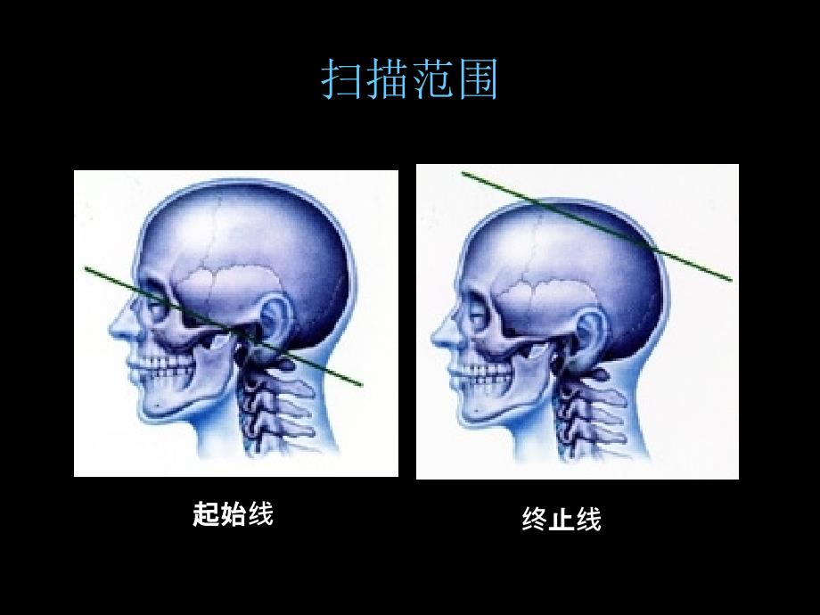 CT影像教学片实验课件_第2页