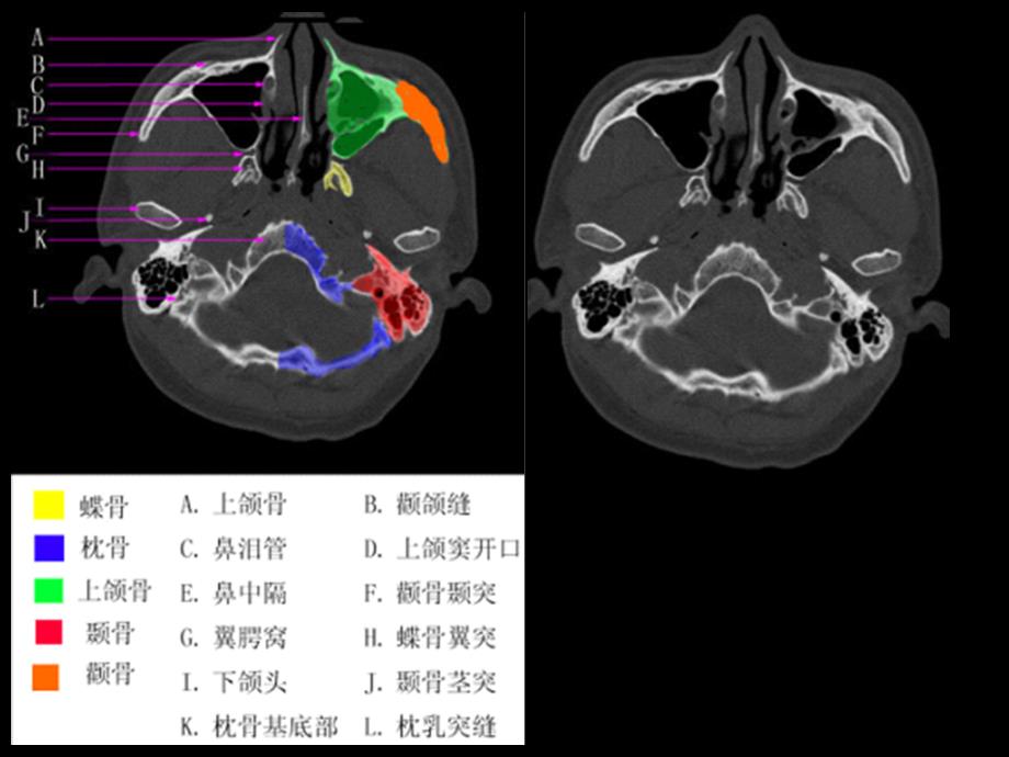 CT影像教学片实验课件_第4页