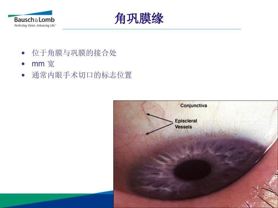 眼科超乳玻切手术基础知识_第5页