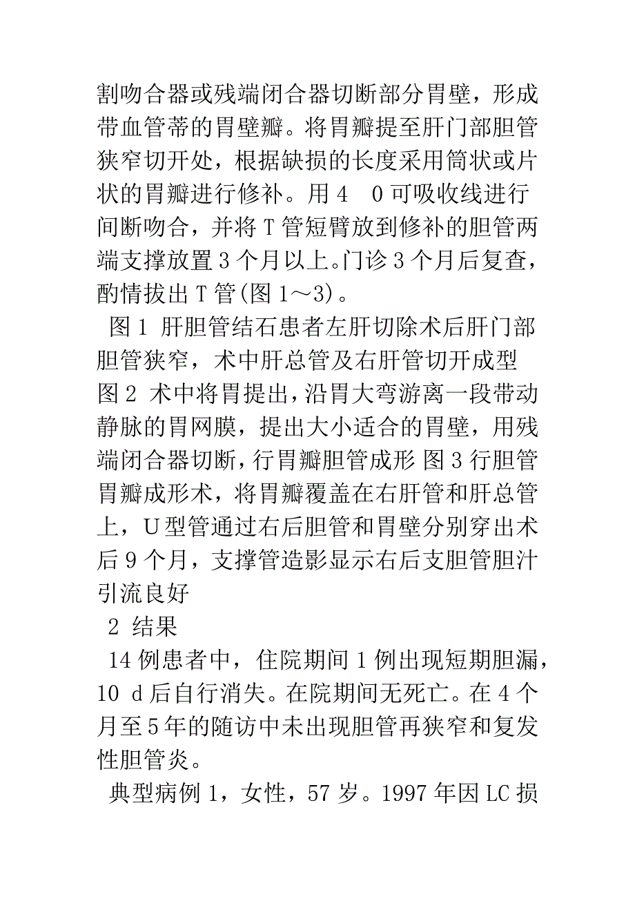 带血管蒂胃瓣修复胆管狭窄.docx_第4页