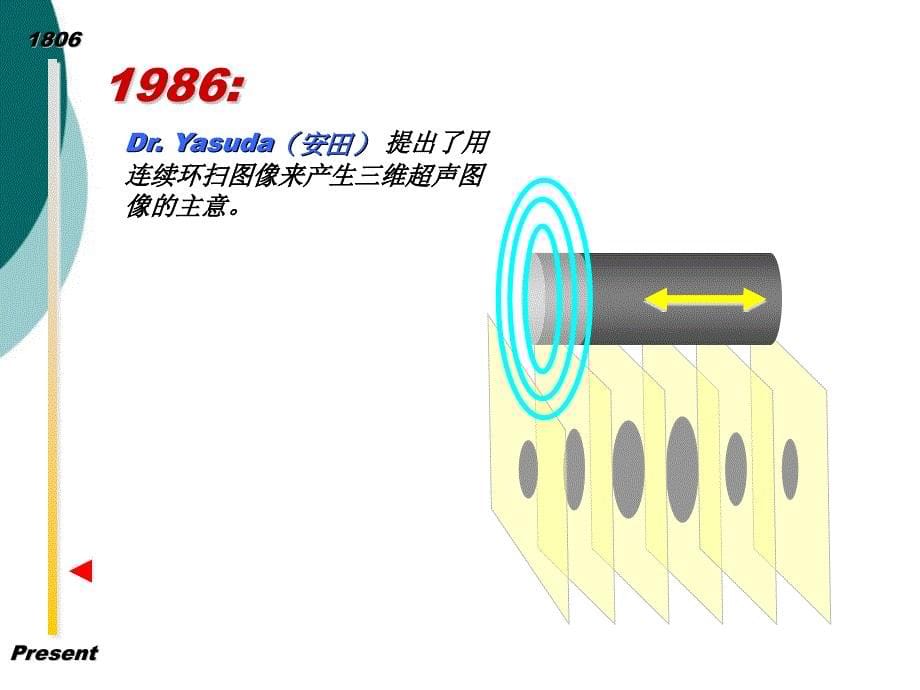 超声内镜的基础课件_第5页