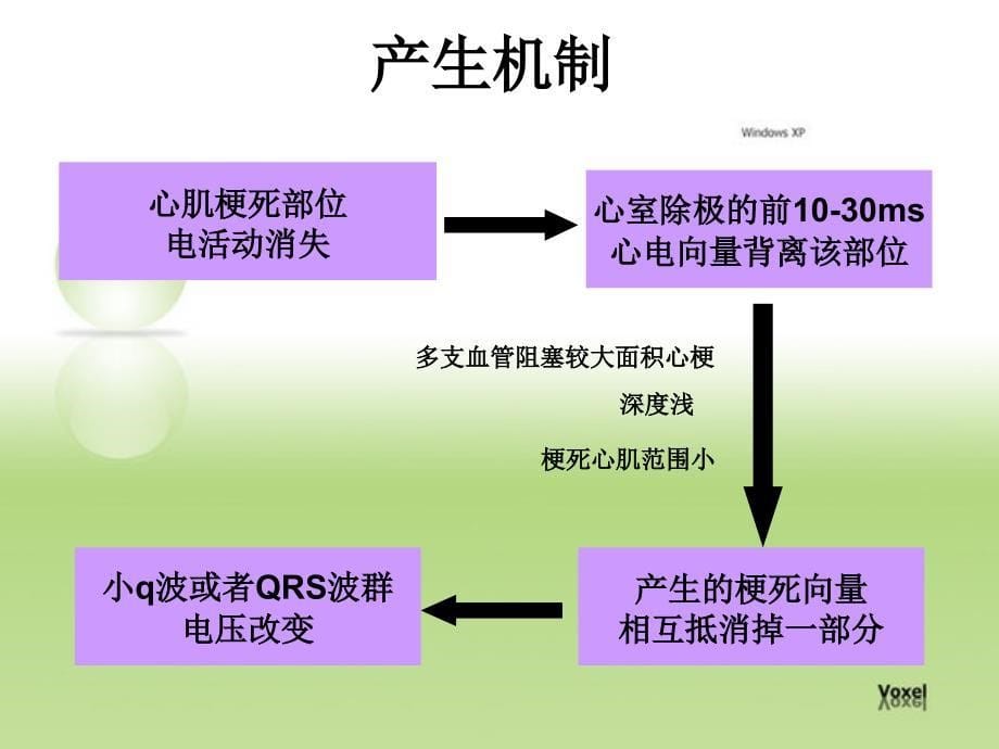 等位性Q波在心肌梗死中的应用_第5页