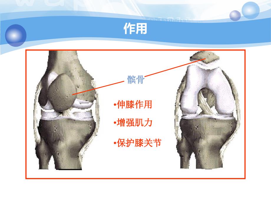 髌骨骨折护理查房PPT通用课件_第4页