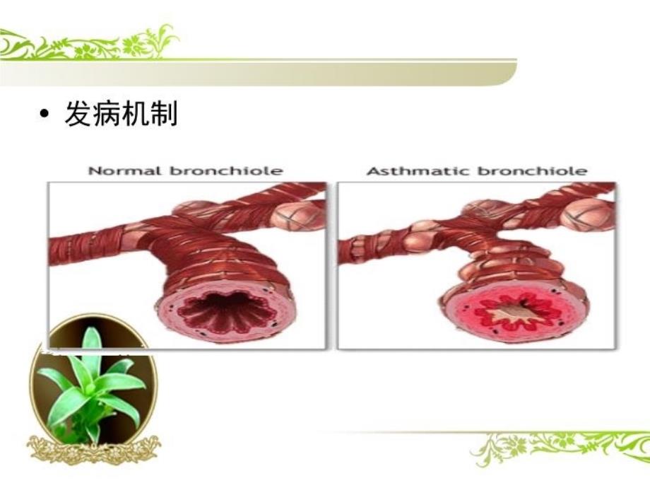 儿童哮喘的教育及护理_第5页