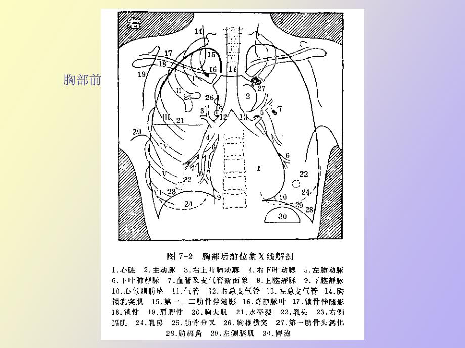 正常胸片胸部CT阅读_第3页