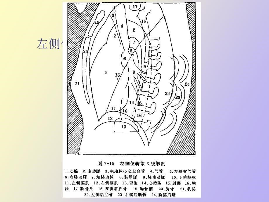 正常胸片胸部CT阅读_第5页