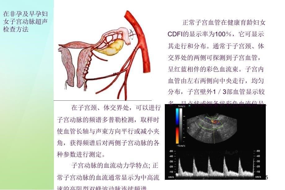 子宫动脉超声监测ppt课件_第5页