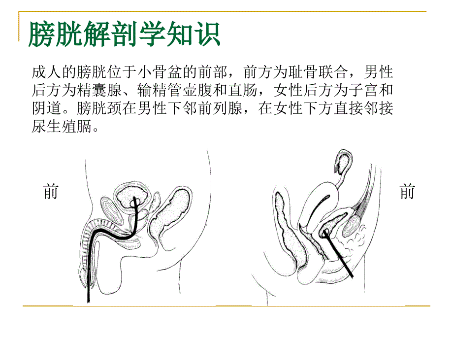 4024659031膀胱冲洗_第3页