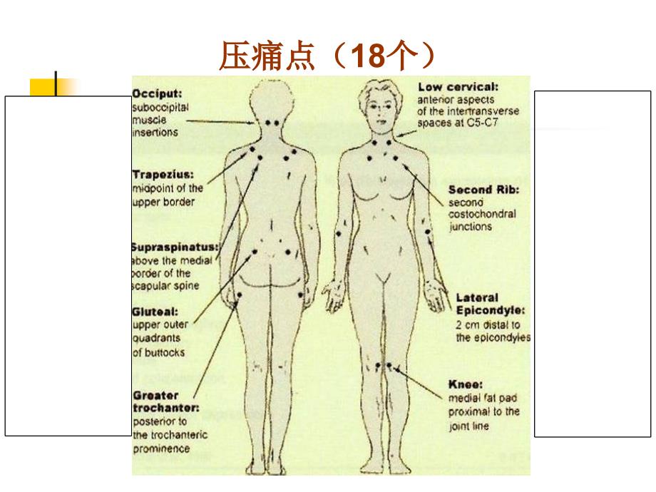 《纤维肌痛综合征》PPT课件_第3页