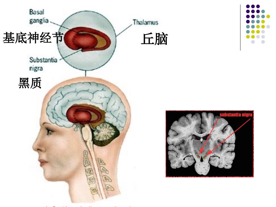 药理学教学课件第11章治疗中枢神经系统退行性疾病药物_第3页